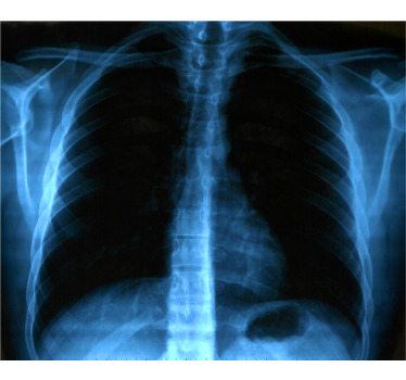 Bordás röntgen halloween ing - TenStickers